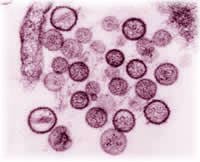 The deadly Hantavirus from rodents