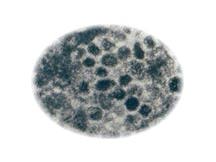 SARS Virus infects cells.