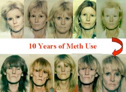 The Face of Meth