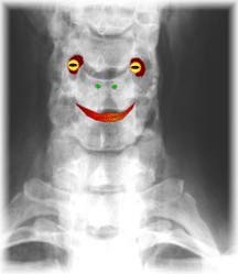 A little fun with a neck X-ray